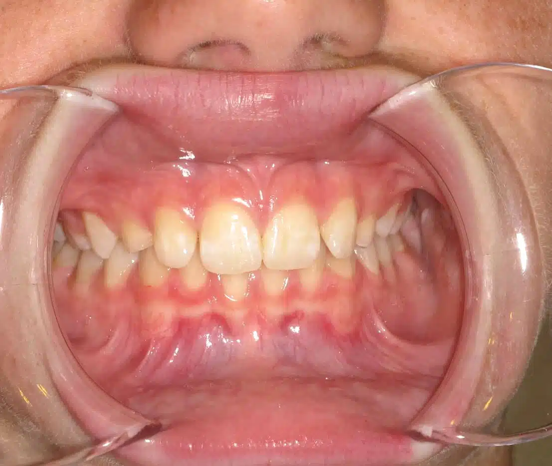 Orthodontic treatment testimonials at Windermere Orthodontics