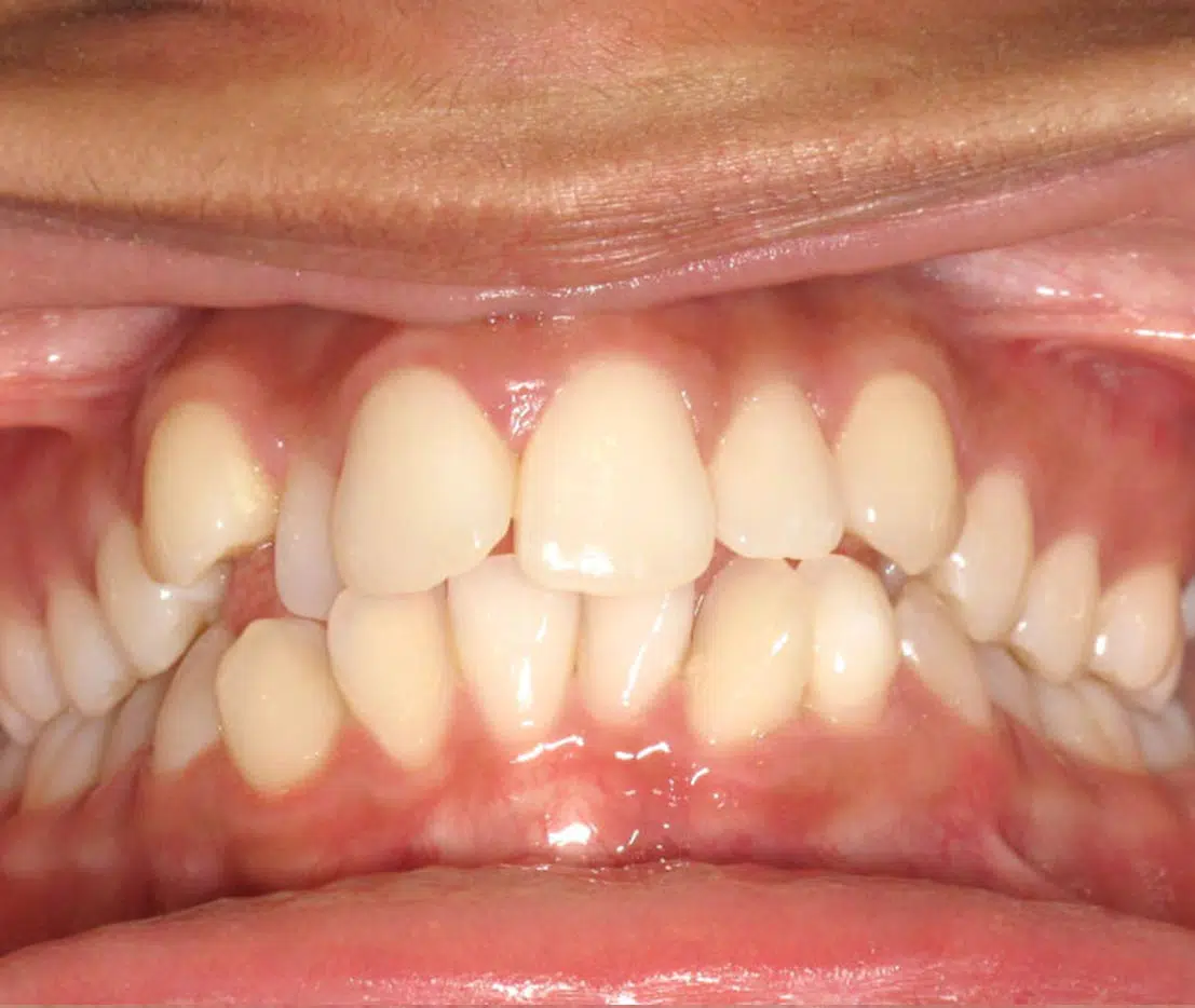 Orthodontic case studies at Windermere Orthodontics