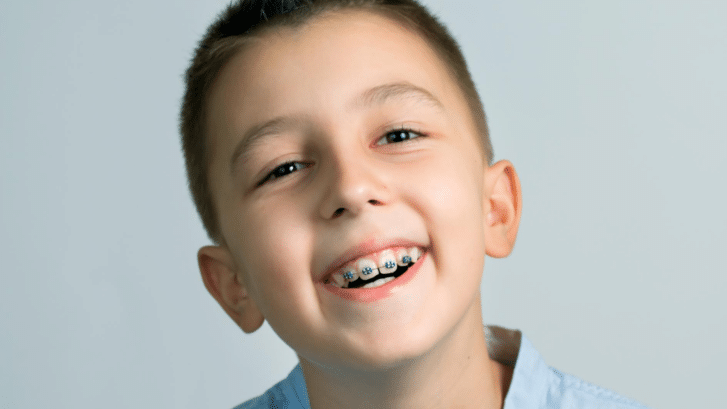 Top Benefits of Orthodontic Care in Suwanee