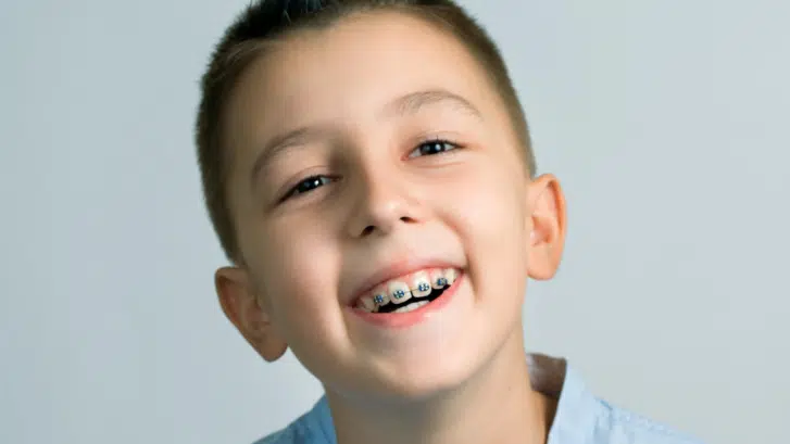 Top Benefits of Orthodontic Care in Suwanee