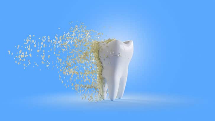 5 Dental trends on social media that will destroy your teeth